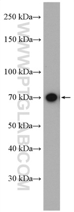 WRAP53 Antibody in Western Blot (WB)