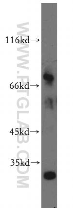 M-CSF Antibody in Western Blot (WB)