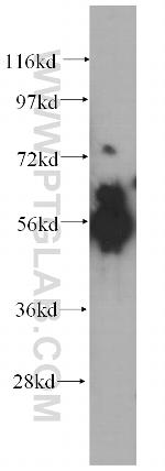 ATP6V1B1 Antibody in Western Blot (WB)