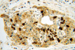 CBS Antibody in Immunohistochemistry (Paraffin) (IHC (P))