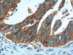 CBS Antibody in Immunohistochemistry (Paraffin) (IHC (P))