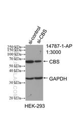 CBS Antibody in Western Blot (WB)