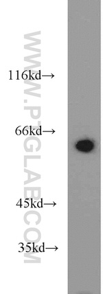 CBS Antibody in Western Blot (WB)