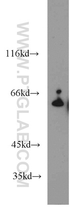 CBS Antibody in Western Blot (WB)