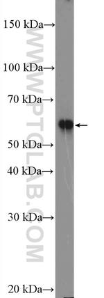 CBS Antibody in Western Blot (WB)