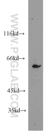 CBS Antibody in Western Blot (WB)