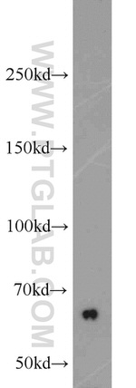 CBS Antibody in Western Blot (WB)