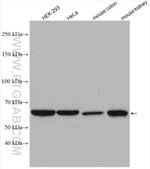 CBS Antibody in Western Blot (WB)