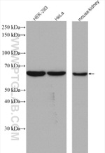 CBS Antibody in Western Blot (WB)