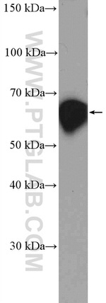 CBS Antibody in Western Blot (WB)