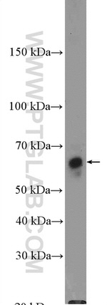 CBS Antibody in Western Blot (WB)