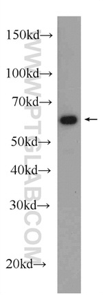 CBS Antibody in Western Blot (WB)