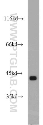 GOT2 Antibody in Western Blot (WB)