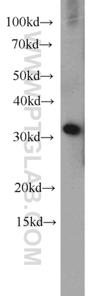 EXOSC2 Antibody in Western Blot (WB)