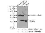 EXOSC2 Antibody in Immunoprecipitation (IP)