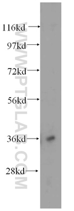 HMOX2 Antibody in Western Blot (WB)