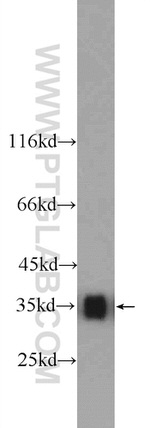 LDHB Antibody in Western Blot (WB)