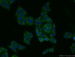 PIG3 Antibody in Immunocytochemistry (ICC/IF)