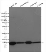 SEC61B Antibody in Western Blot (WB)