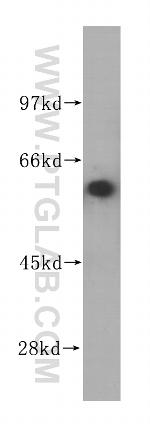 APPBP1 Antibody in Western Blot (WB)
