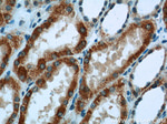 SDHA Antibody in Immunohistochemistry (Paraffin) (IHC (P))