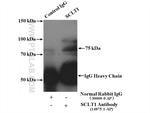 SCLT1 Antibody in Immunoprecipitation (IP)