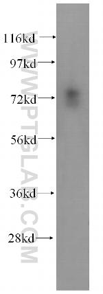 SCLT1 Antibody in Western Blot (WB)