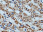 ATP5D Antibody in Immunohistochemistry (Paraffin) (IHC (P))