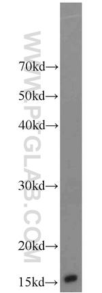 ATP5D Antibody in Western Blot (WB)