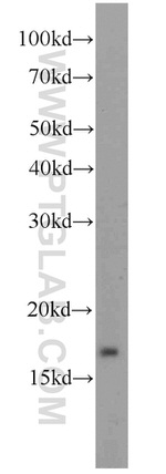 ATP5D Antibody in Western Blot (WB)