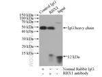 RBX1 Antibody in Immunoprecipitation (IP)