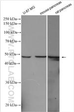 DDOST Antibody in Western Blot (WB)