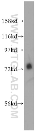 MEPCE Antibody in Western Blot (WB)