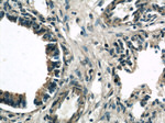 TIM22 Antibody in Immunohistochemistry (Paraffin) (IHC (P))