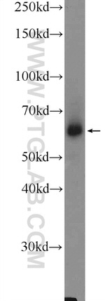 GNPAT Antibody in Western Blot (WB)