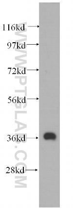 MECR Antibody in Western Blot (WB)