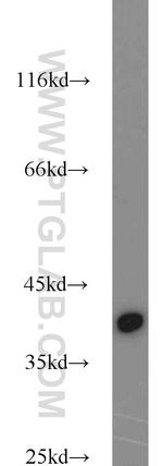 URAT1 Antibody in Western Blot (WB)