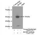 BLMH Antibody in Immunoprecipitation (IP)