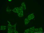 ZAK Antibody in Immunocytochemistry (ICC/IF)