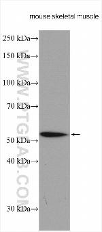 ZAK Antibody in Western Blot (WB)