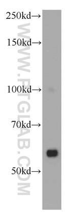 ZAK Antibody in Western Blot (WB)