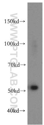 ZAK Antibody in Western Blot (WB)