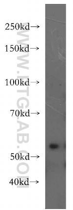 ZAK Antibody in Western Blot (WB)