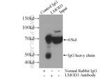 LMOD3 Antibody in Immunoprecipitation (IP)