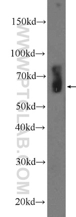 LMOD3 Antibody in Western Blot (WB)