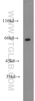 LMOD3 Antibody in Western Blot (WB)