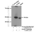 SNIP1 Antibody in Immunoprecipitation (IP)