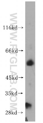 Kir6.1 Antibody in Western Blot (WB)