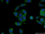 OAS1 Antibody in Immunocytochemistry (ICC/IF)