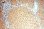 OAS1 Antibody in Immunohistochemistry (Paraffin) (IHC (P))